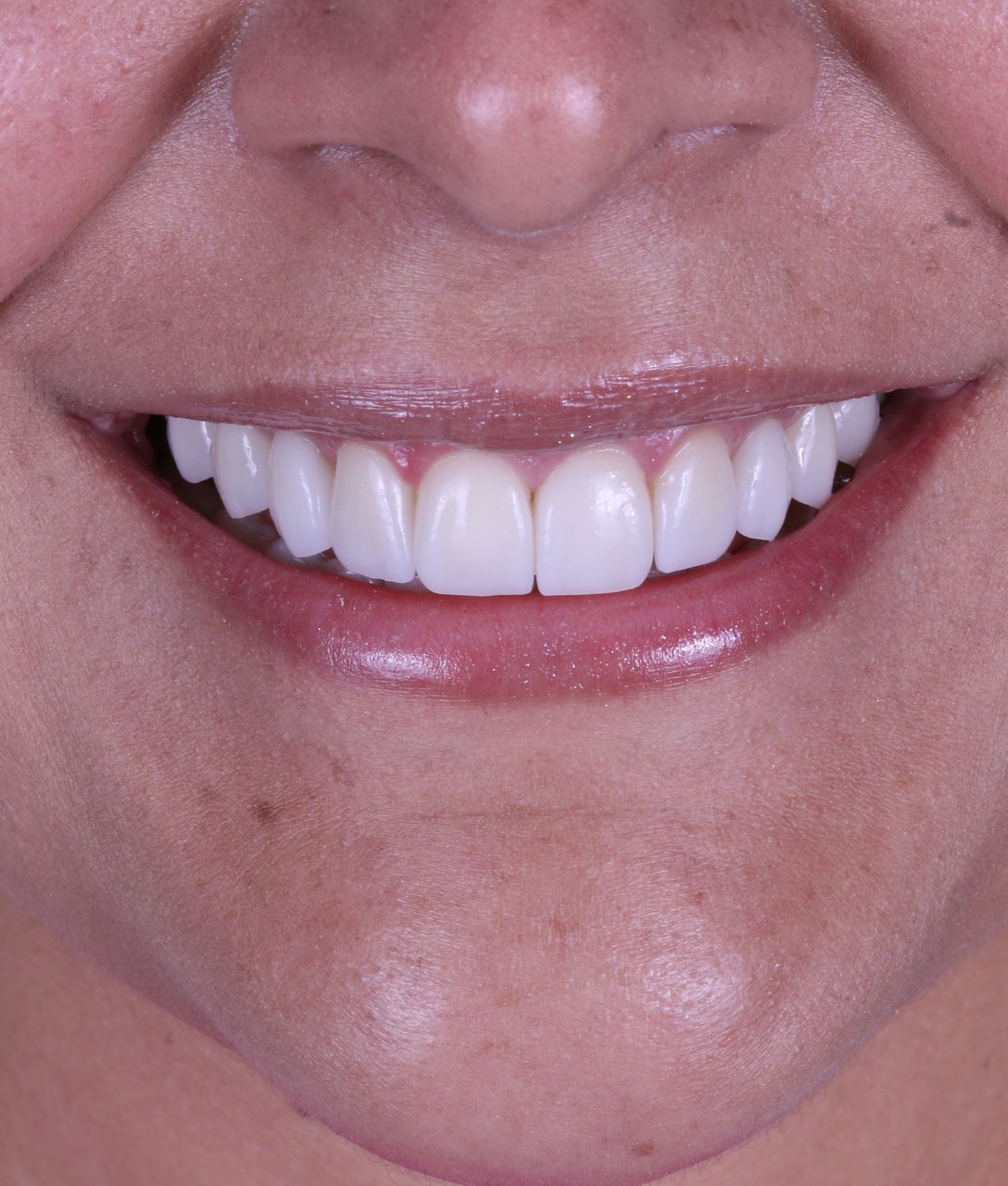 Detalle de la sonrisa