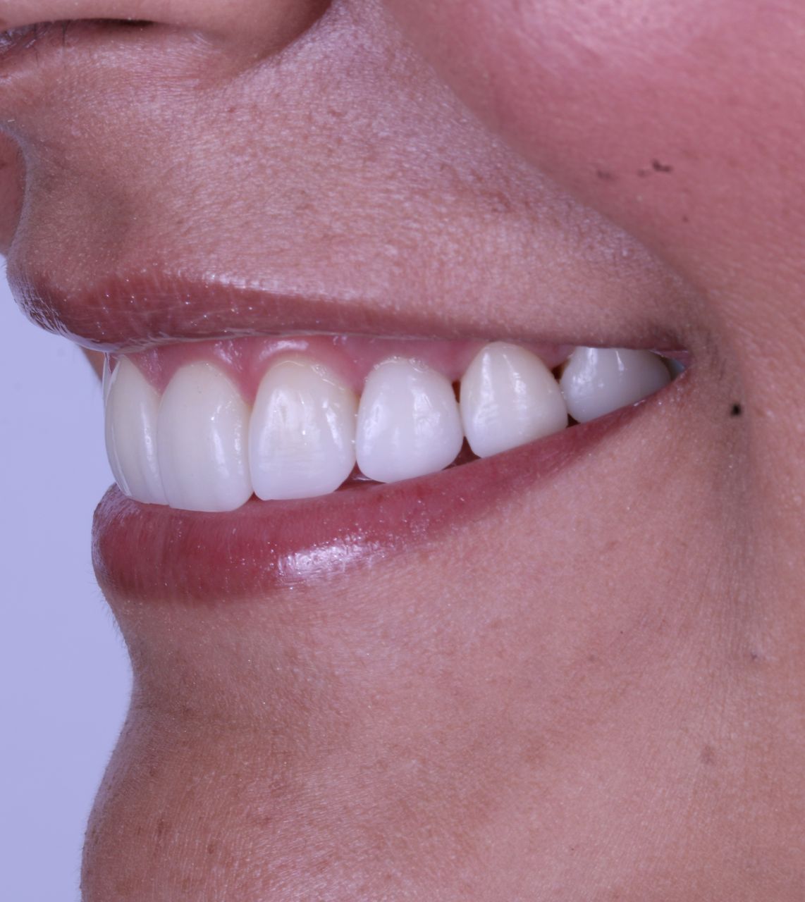 Sonrisa de perfil