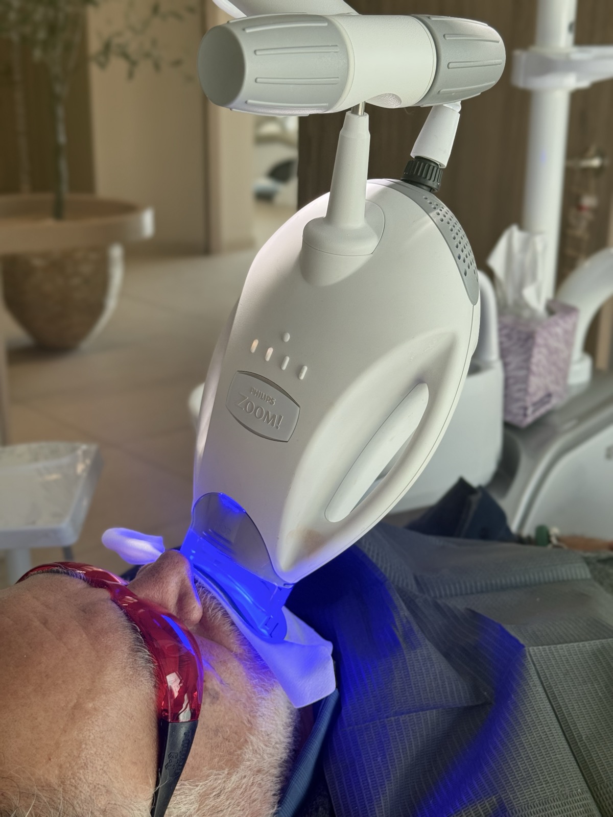 Equipo Philips Zoom durante el blanqueamiento dental
